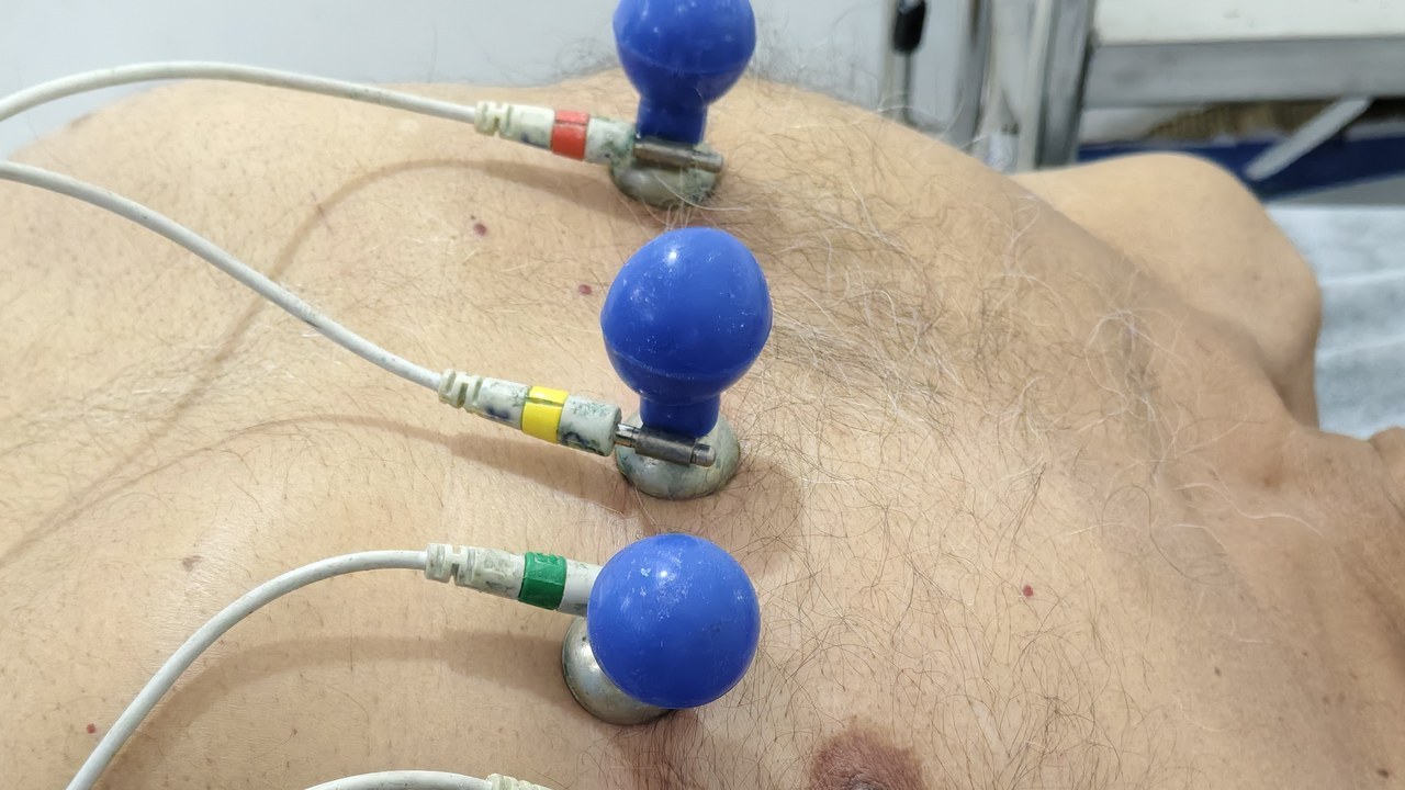 Image Credit: Electrocardiography/fresh